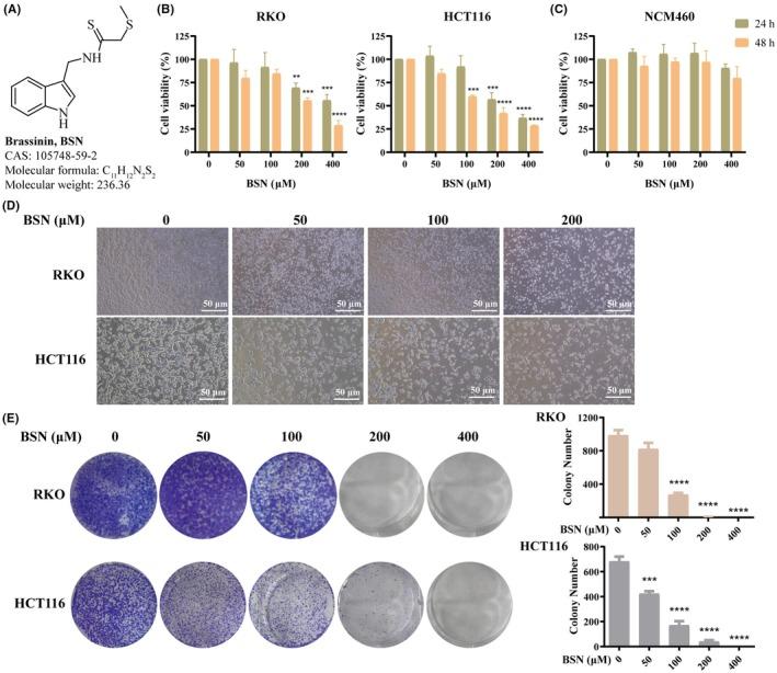 https://cdn.ncbi.nlm.nih.gov/pmc/blobs/a2ae/12431579/190c51307547/AME2-8-1155-g006.jpg