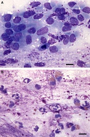 https://cdn.ncbi.nlm.nih.gov/pmc/blobs/a2b1/4895494/c6ee3fec1da3/JVIM-29-526-g001.jpg