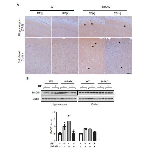 https://cdn.ncbi.nlm.nih.gov/pmc/blobs/a2bc/5445699/51c3368497a9/CAR-12-481_F3.jpg