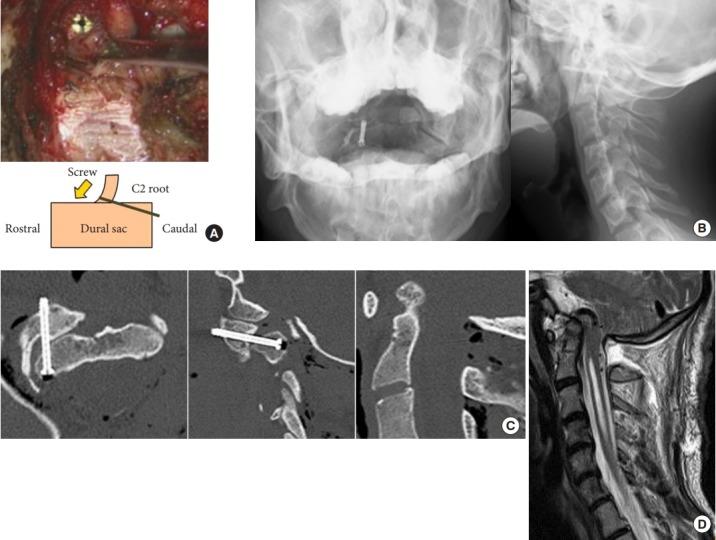 https://cdn.ncbi.nlm.nih.gov/pmc/blobs/a2be/6603847/752ce8af6889/ns-1836118-059f4.jpg