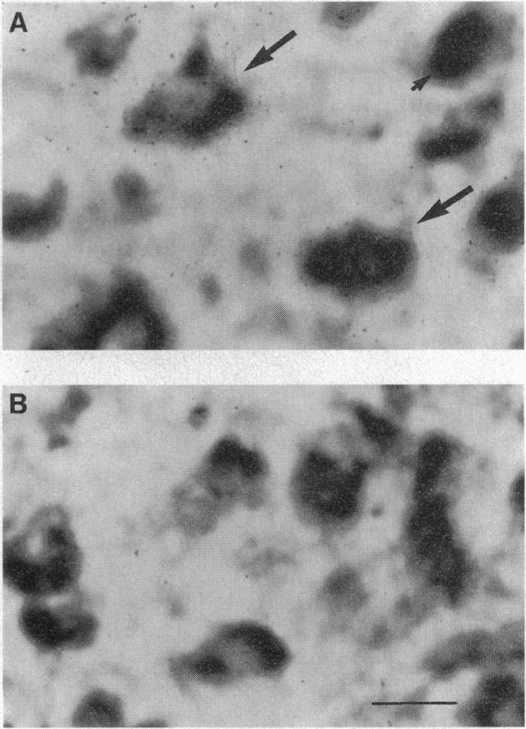 https://cdn.ncbi.nlm.nih.gov/pmc/blobs/a2c2/41052/240f9f4c005f/pnas01497-0266-a.jpg