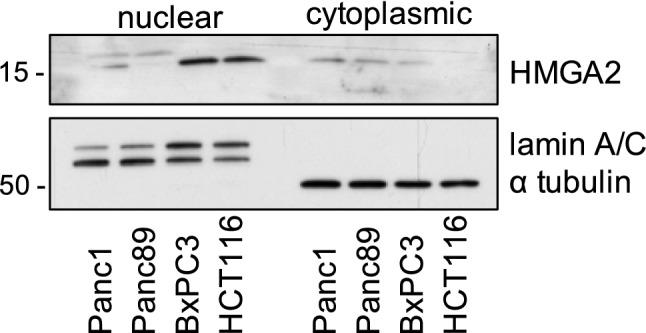 https://cdn.ncbi.nlm.nih.gov/pmc/blobs/a2c5/11802021/527ec3b6e252/432_2021_3745_Fig1_HTML.jpg