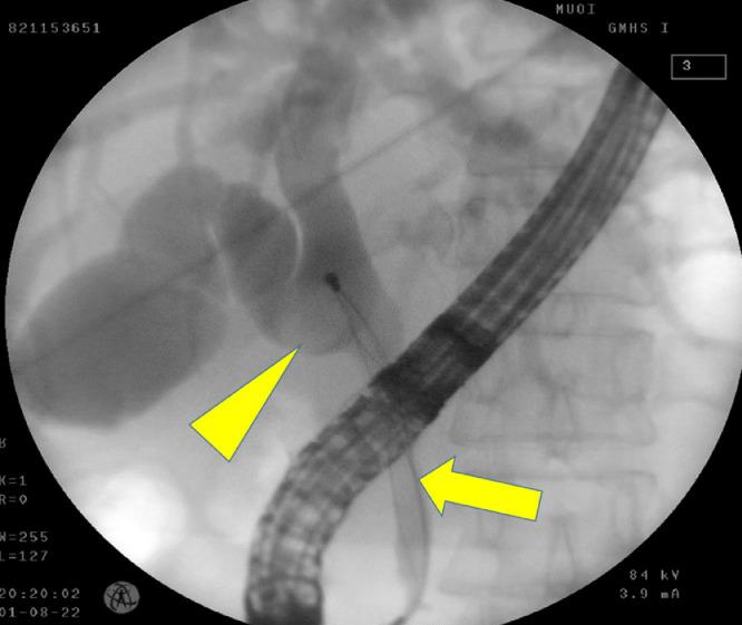 https://cdn.ncbi.nlm.nih.gov/pmc/blobs/a2c6/10241654/8cf964186dc8/gr2.jpg