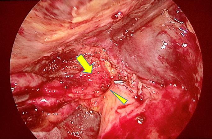 https://cdn.ncbi.nlm.nih.gov/pmc/blobs/a2c6/10241654/ef3e5a74ed86/gr3.jpg