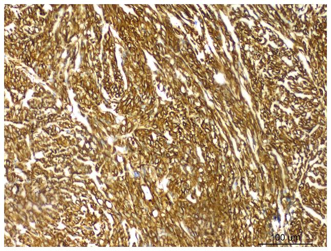 https://cdn.ncbi.nlm.nih.gov/pmc/blobs/a2c7/11528181/63304ef6a5ca/ol-28-06-14744-g03.jpg