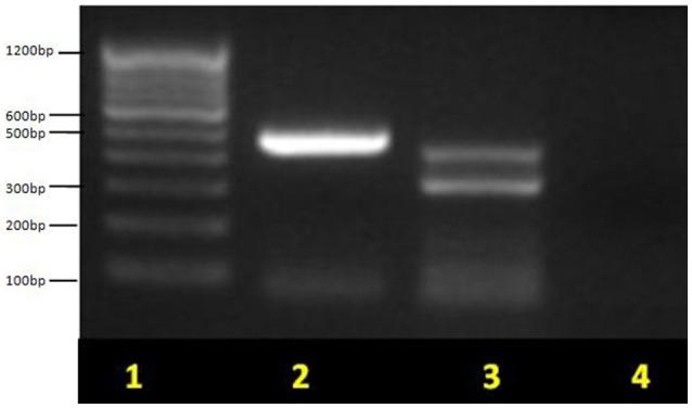 https://cdn.ncbi.nlm.nih.gov/pmc/blobs/a2cb/5385330/60bd7c4ca553/fmicb-08-00561-g0001.jpg
