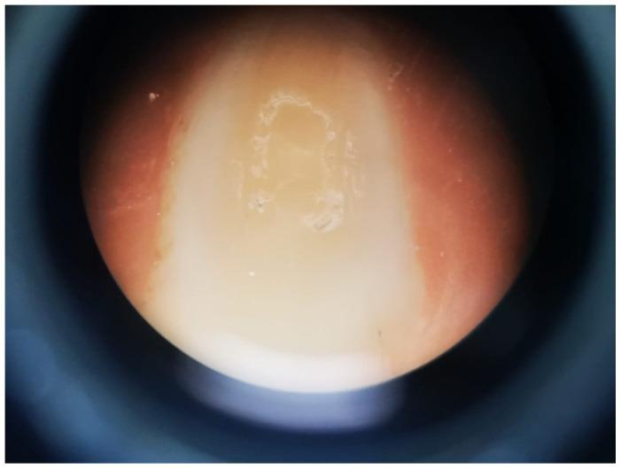 https://cdn.ncbi.nlm.nih.gov/pmc/blobs/a2cc/9405332/9e5c1051a550/bioengineering-09-00372-g004.jpg