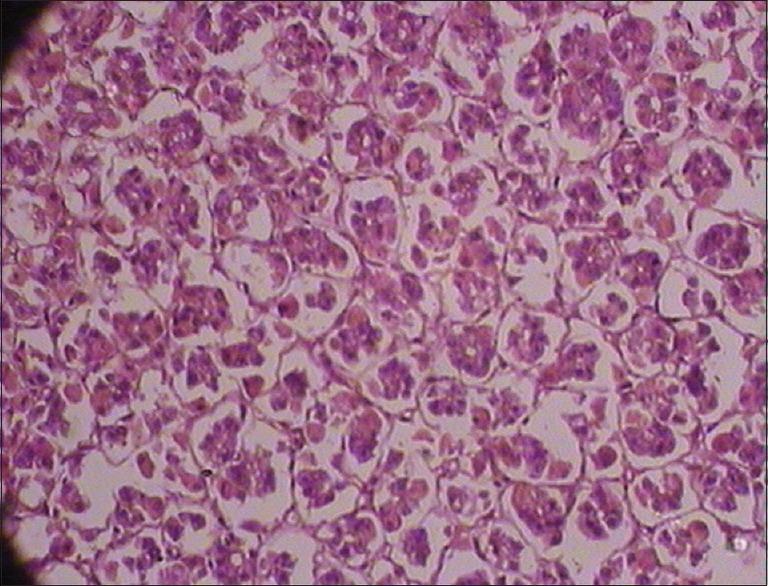 https://cdn.ncbi.nlm.nih.gov/pmc/blobs/a2cd/4492030/e28fc7399808/AYU-35-433-g008.jpg