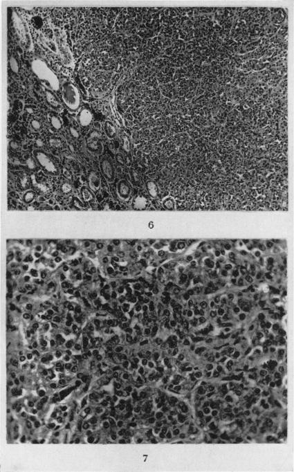 https://cdn.ncbi.nlm.nih.gov/pmc/blobs/a2f0/2070927/424739692ee7/brjcancer00499-0139-a.jpg