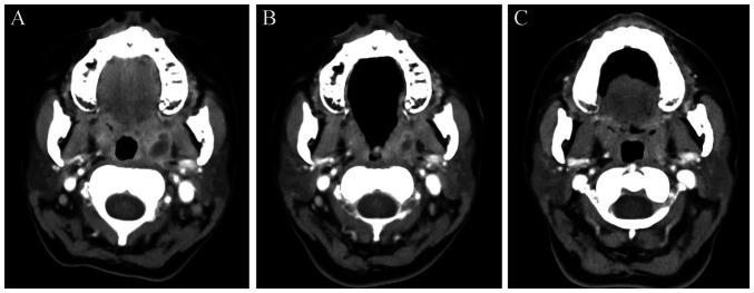 https://cdn.ncbi.nlm.nih.gov/pmc/blobs/a2f0/9829232/2b44016fd3cb/mi-02-05-00055-g00.jpg