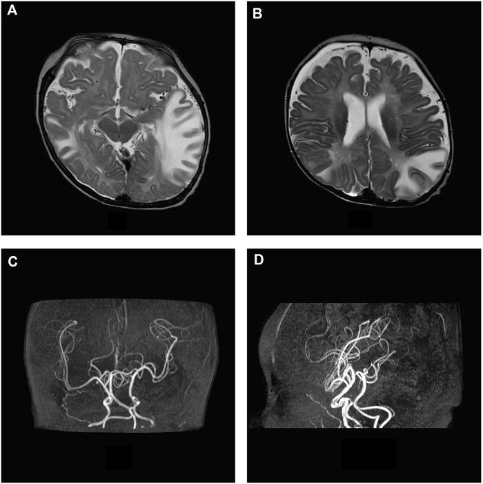 https://cdn.ncbi.nlm.nih.gov/pmc/blobs/a2f4/10017521/7b7c53fbb950/fgene-14-1077625-g002.jpg
