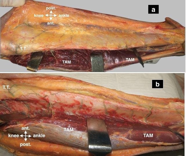 https://cdn.ncbi.nlm.nih.gov/pmc/blobs/a2fc/12404821/682ecc5199cb/BJR-2024-0547.R2-galleyfig2.jpg