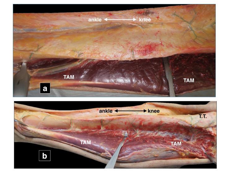 https://cdn.ncbi.nlm.nih.gov/pmc/blobs/a2fc/12404821/700a89074597/BJR-2024-0547.R2-galleyfig3.jpg