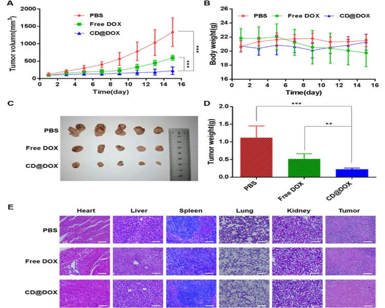 https://cdn.ncbi.nlm.nih.gov/pmc/blobs/a2ff/10874252/aac8d8a09eb2/cureus-0016-00000052511-i07.jpg
