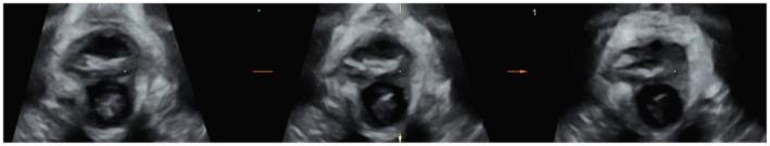 https://cdn.ncbi.nlm.nih.gov/pmc/blobs/a308/10083999/400dab1cf0e3/IJGO-160-93-g001.jpg