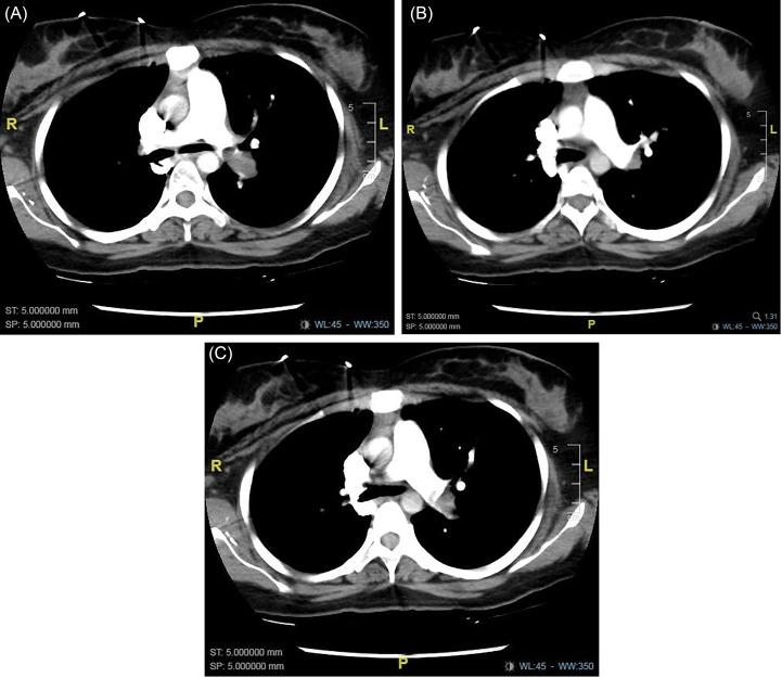 https://cdn.ncbi.nlm.nih.gov/pmc/blobs/a318/11298809/e0ad6589e198/gr1.jpg