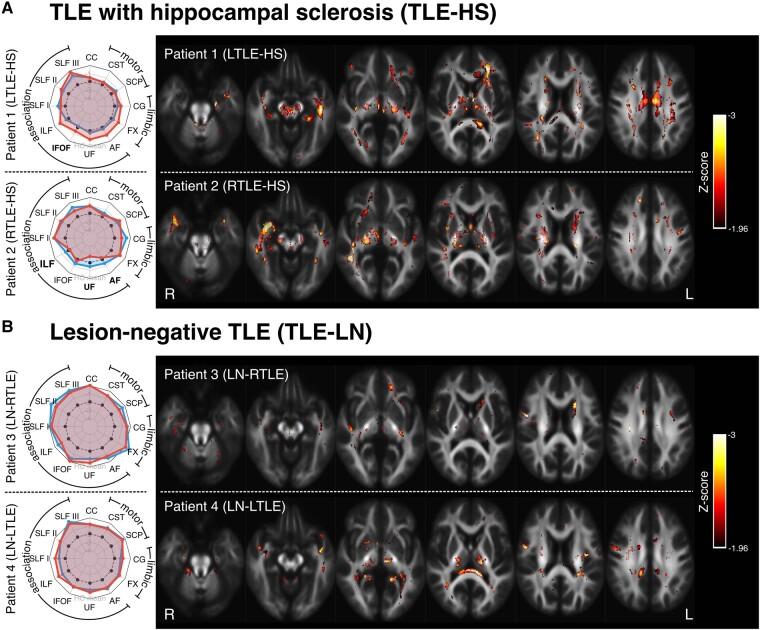 https://cdn.ncbi.nlm.nih.gov/pmc/blobs/a31b/10768884/c766d97dff6d/fcad352f3.jpg