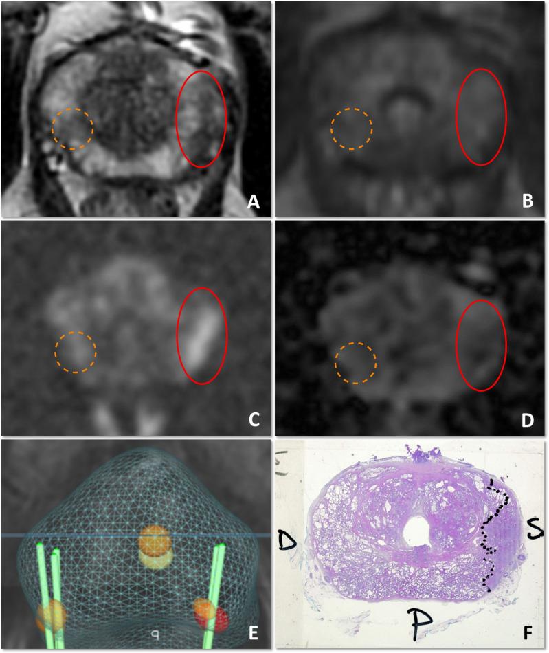 https://cdn.ncbi.nlm.nih.gov/pmc/blobs/a31b/8978234/5b33f9071baa/bjr.20210528.g001.jpg