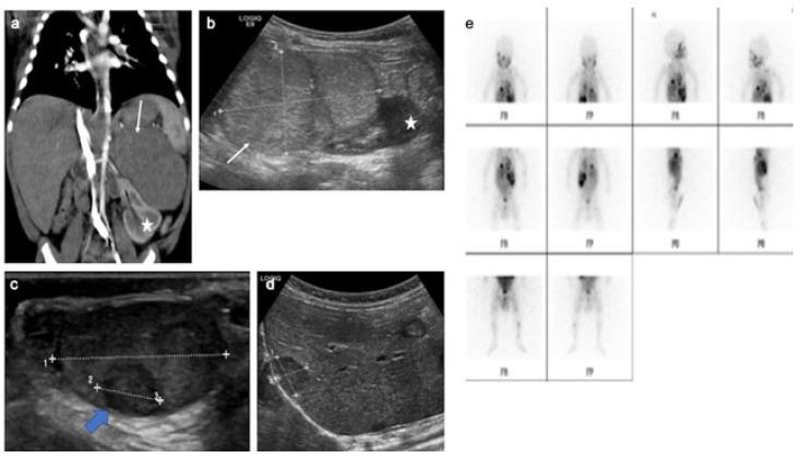 https://cdn.ncbi.nlm.nih.gov/pmc/blobs/a31d/9265135/8634e5366968/cancers-14-03180-g009.jpg