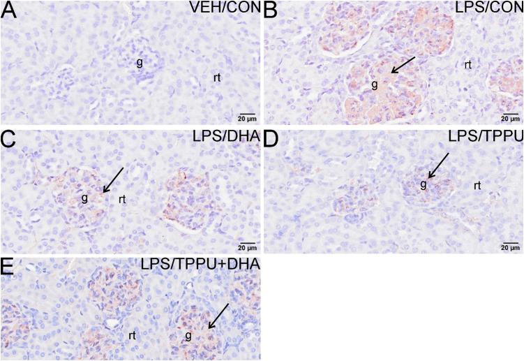 https://cdn.ncbi.nlm.nih.gov/pmc/blobs/a31d/9978350/166b9705782e/fimmu-14-1124910-g010.jpg