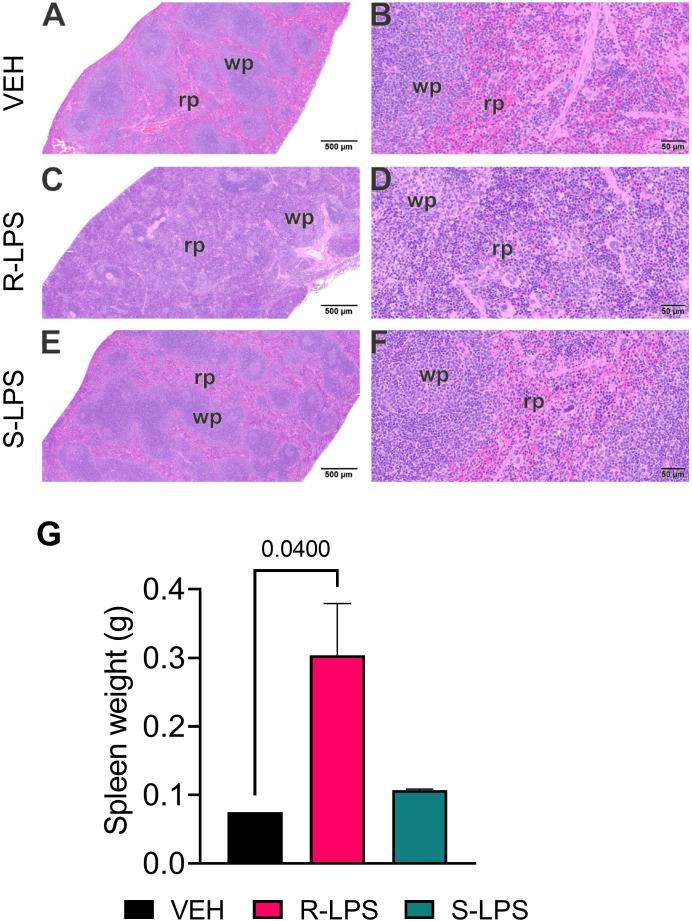 https://cdn.ncbi.nlm.nih.gov/pmc/blobs/a31d/9978350/1be4c2895f37/fimmu-14-1124910-g004.jpg