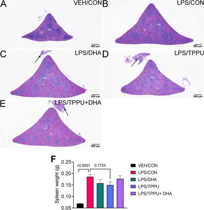 https://cdn.ncbi.nlm.nih.gov/pmc/blobs/a31d/9978350/5c64dfbf9472/fimmu-14-1124910-g011.jpg