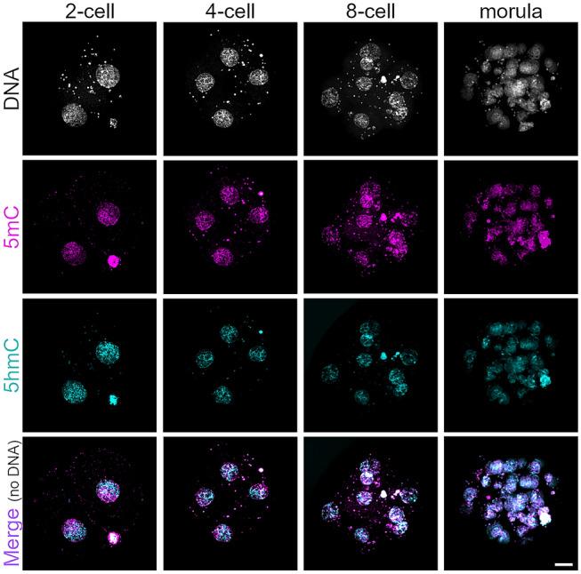 https://cdn.ncbi.nlm.nih.gov/pmc/blobs/a31e/8460514/cd35aa34d05c/418_2021_2008_Fig2_HTML.jpg