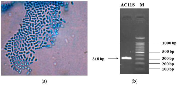 https://cdn.ncbi.nlm.nih.gov/pmc/blobs/a326/11051871/4a417756c655/microorganisms-12-00739-g001.jpg