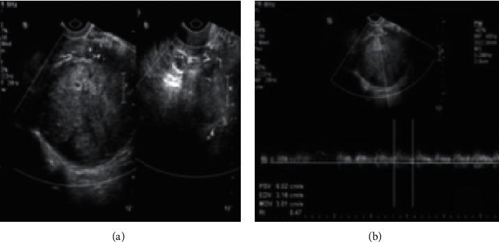 https://cdn.ncbi.nlm.nih.gov/pmc/blobs/a326/8387196/20106c7cc6d8/CMMI2021-2146578.006.jpg