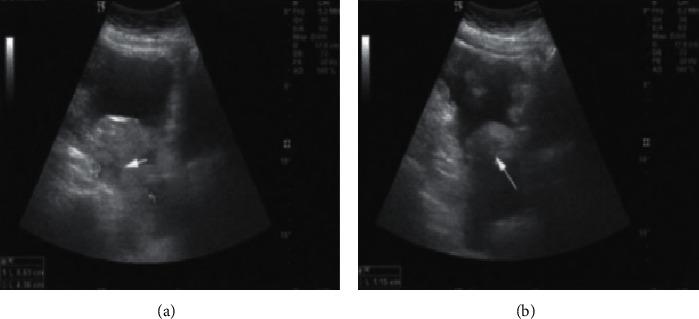 https://cdn.ncbi.nlm.nih.gov/pmc/blobs/a326/8387196/8f9ccff7859e/CMMI2021-2146578.004.jpg