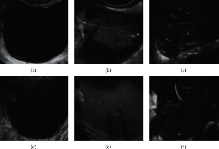 https://cdn.ncbi.nlm.nih.gov/pmc/blobs/a326/8387196/c60b6c74cec6/CMMI2021-2146578.002.jpg