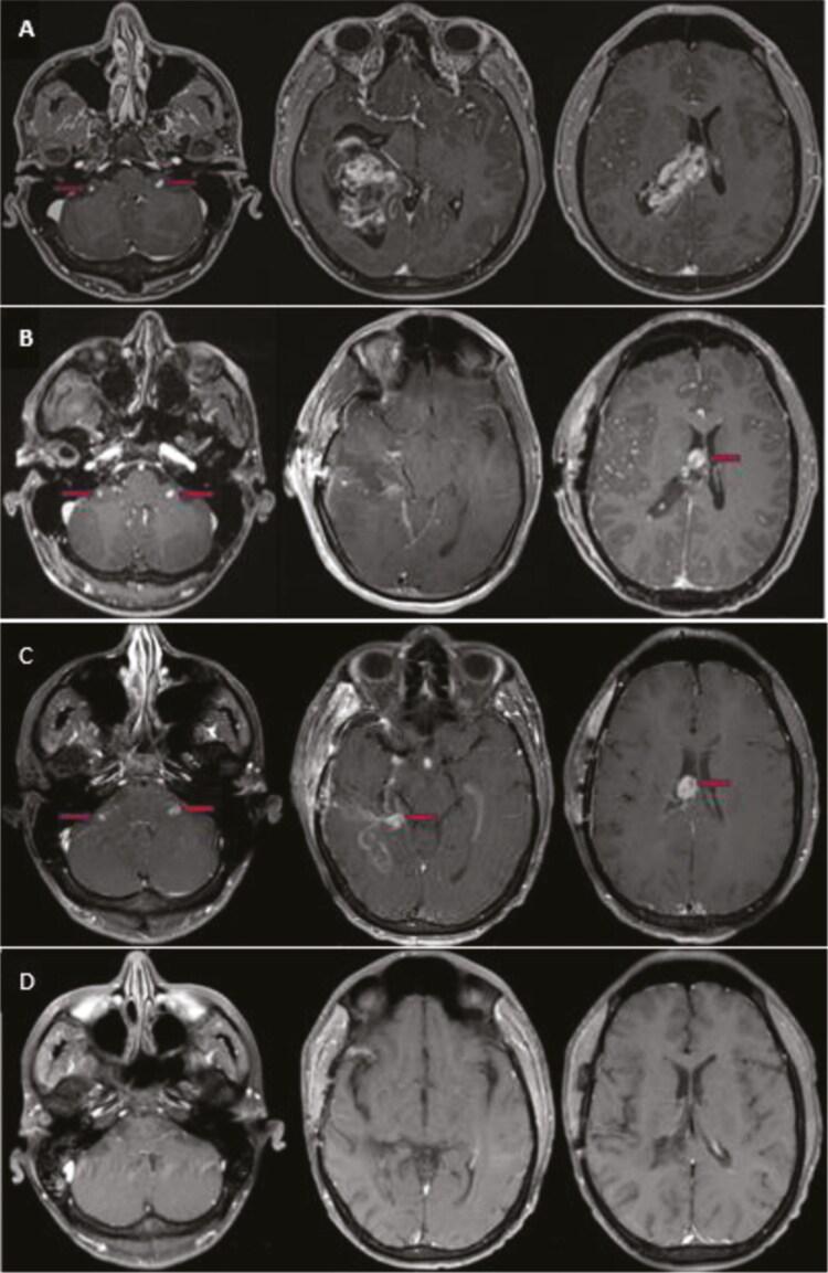 https://cdn.ncbi.nlm.nih.gov/pmc/blobs/a32d/11783278/33193b85248a/oyae100_fig1.jpg