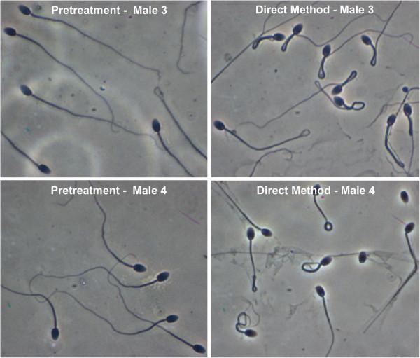 https://cdn.ncbi.nlm.nih.gov/pmc/blobs/a32d/3447693/b7cd787198c5/1477-7827-10-81-3.jpg