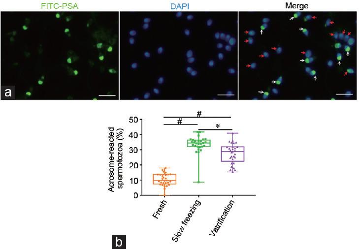 https://cdn.ncbi.nlm.nih.gov/pmc/blobs/a331/7831840/d0193c1e36f9/AJA-23-91-g003.jpg