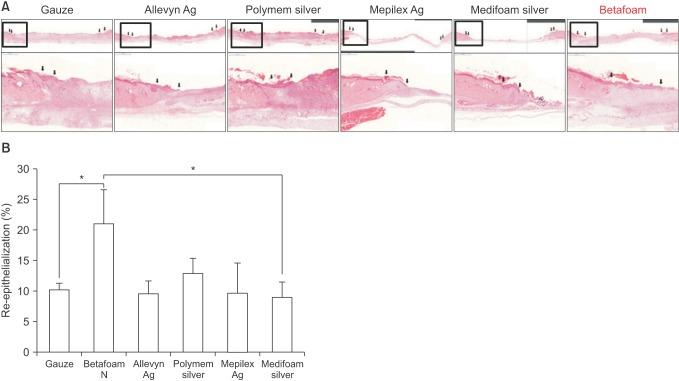 https://cdn.ncbi.nlm.nih.gov/pmc/blobs/a333/5765272/60a9fcae5ef3/astr-94-1-g004.jpg