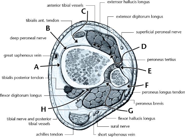 https://cdn.ncbi.nlm.nih.gov/pmc/blobs/a335/5590002/5a32a595e90a/eor-2-352-g005.jpg