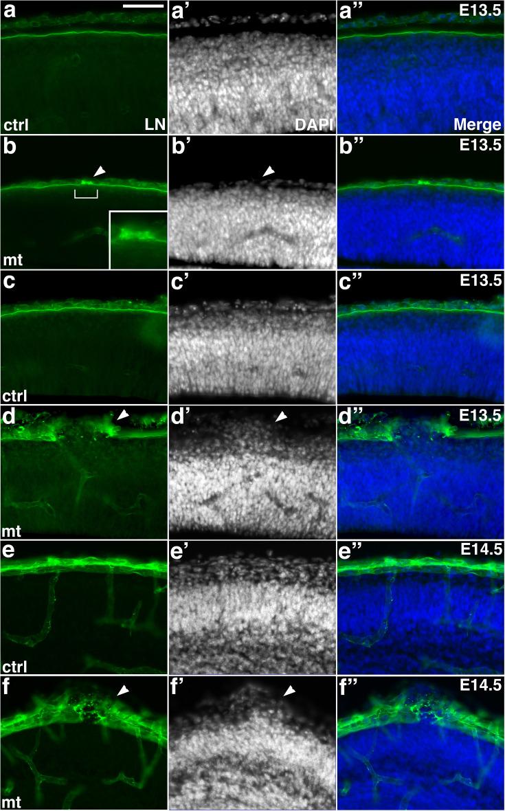 https://cdn.ncbi.nlm.nih.gov/pmc/blobs/a33d/11620749/c9f5dca5c8c7/elife-100446-fig1-figsupp4.jpg