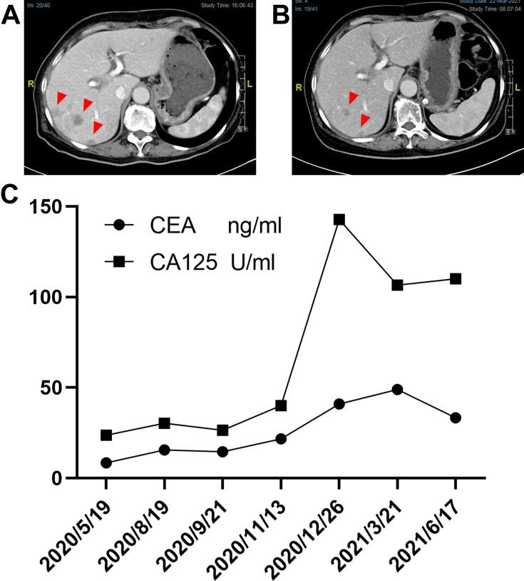 https://cdn.ncbi.nlm.nih.gov/pmc/blobs/a33e/9423042/fb66f4605baa/OTT-15-891-g0002.jpg