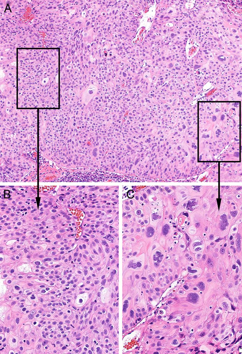 https://cdn.ncbi.nlm.nih.gov/pmc/blobs/a340/11181758/9181b8b79ac3/blc-9-blc220106-g002.jpg