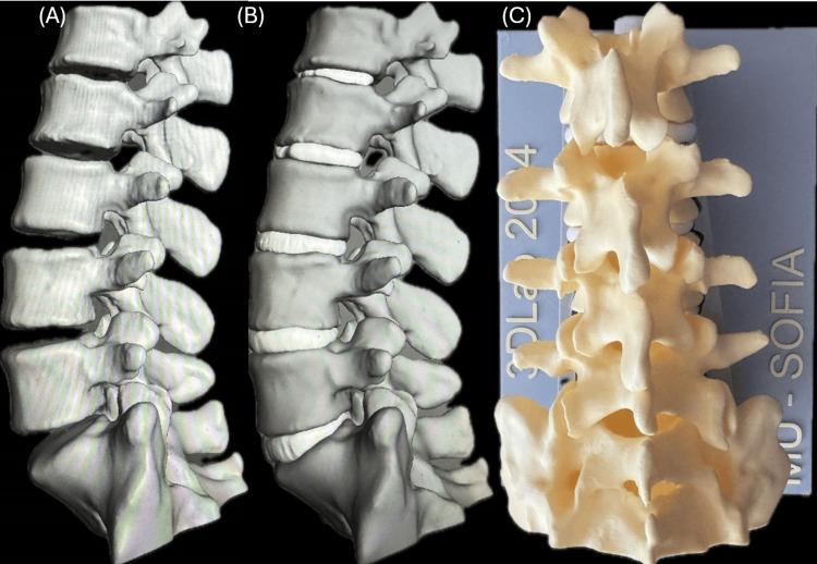 https://cdn.ncbi.nlm.nih.gov/pmc/blobs/a343/12033040/3c97c2004aea/cureus-0017-00000081297-i01.jpg