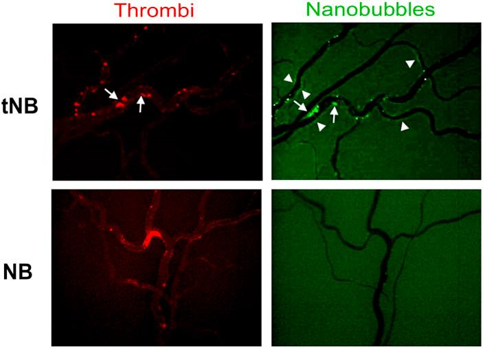 https://cdn.ncbi.nlm.nih.gov/pmc/blobs/a34b/10316273/3241420e06bc/1081861.fig5.jpg