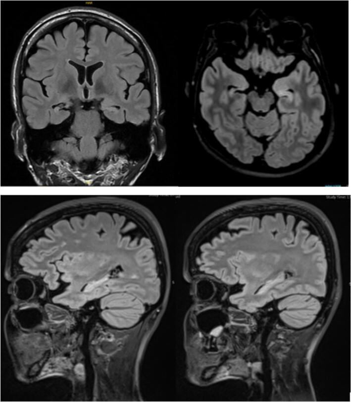 https://cdn.ncbi.nlm.nih.gov/pmc/blobs/a35a/12270791/cd267c7fe2d1/gr2.jpg