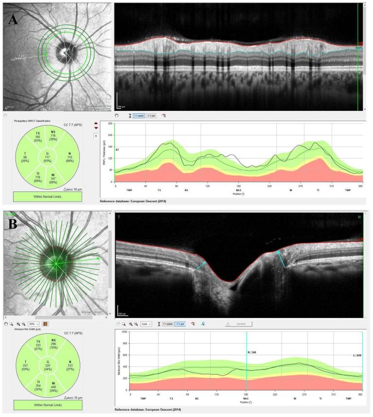 https://cdn.ncbi.nlm.nih.gov/pmc/blobs/a35b/12248526/9bd8a0d4ee7a/diagnostics-15-01682-g002.jpg