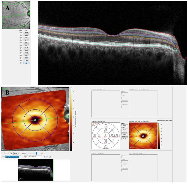 https://cdn.ncbi.nlm.nih.gov/pmc/blobs/a35b/12248526/b44277ae22db/diagnostics-15-01682-g001.jpg