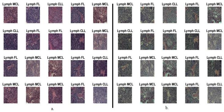 https://cdn.ncbi.nlm.nih.gov/pmc/blobs/a35e/10341222/305ac1e88b04/diagnostics-13-02258-g001.jpg