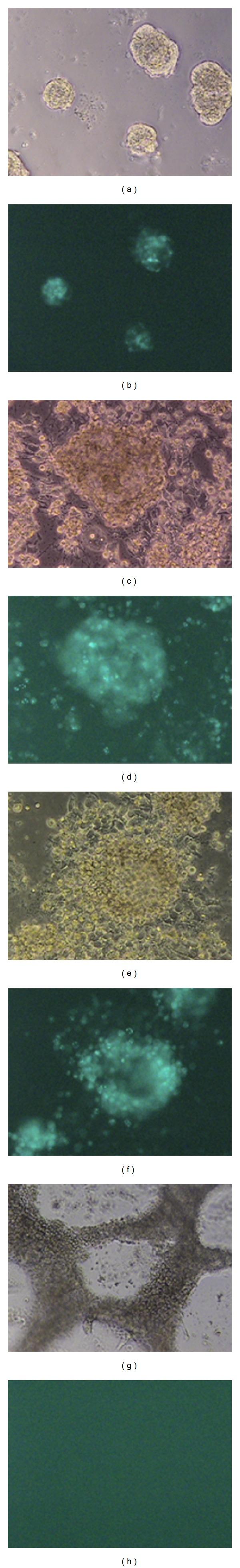 https://cdn.ncbi.nlm.nih.gov/pmc/blobs/a361/3885282/60065c889aaa/ISRN.ONCOLOGY2013-104913.004.jpg