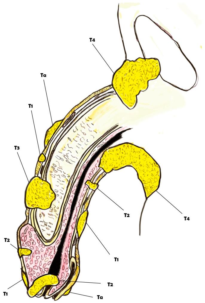 https://cdn.ncbi.nlm.nih.gov/pmc/blobs/a379/11353487/be267b94ba3d/diagnostics-14-01790-g001.jpg