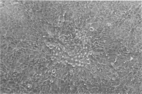 https://cdn.ncbi.nlm.nih.gov/pmc/blobs/a379/171155/9a077445f1a1/jvirol00004-0341-a.jpg