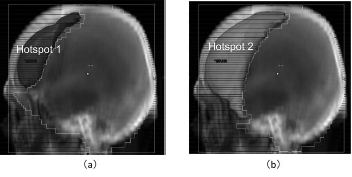 https://cdn.ncbi.nlm.nih.gov/pmc/blobs/a37a/11250019/fe01054b0bc2/2188-2126-68-4-0375-g005.jpg