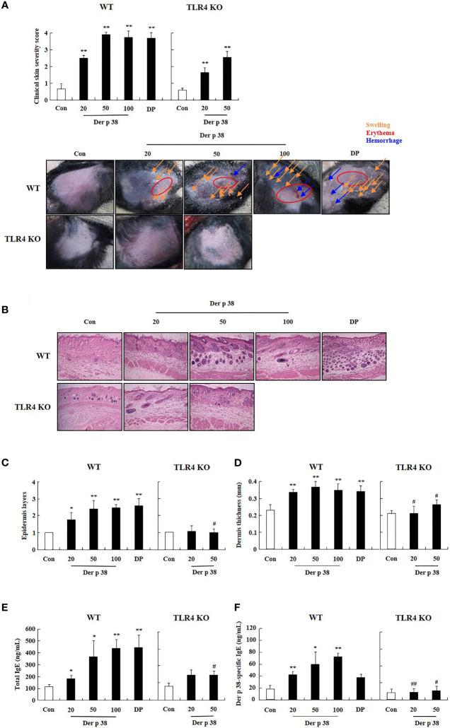 https://cdn.ncbi.nlm.nih.gov/pmc/blobs/a37e/8531521/d20da9bfc426/fimmu-12-646316-g004.jpg